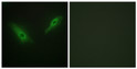 Immunofluorescence analysis of HeLa cells, using KPB1/2 Antibody. The picture on the right is blocked with the synthesized peptide. Immunofluorescence analysis of HeLa cells, using KPB1/2 Antibody. The picture on the right is blocked with the synthesized peptide.