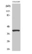 Western blot analysis of various cells using PI-9 Polyclonal Antibody diluted at 1:1000 STJ95081