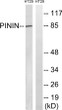 Western blot analysis of lysates from HT-29 cells, using PNN Antibody. The lane on the right was blocked with the STJ95096
