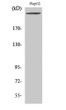 Western Blot analysis of various cells using PIP5KIII Polyclonal Antibody STJ95099