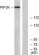 Western blot analysis of lysates from HepG2 cells, using PIP5K Antibody. The lane on the right is blocked with the STJ95099
