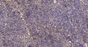 Immunohistochemical analysis of paraffin-embedded human uterus. 1, Antibody was diluted at 1:200 (4° overnight). 2, STJ95099