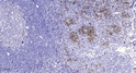 Immunohistochemical analysis of paraffin-embedded human tonsil. 1, Antibody was diluted at 1:200 (4° overnight). 2, STJ95106