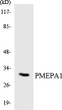 Western blot analysis of the lysates from HeLa cells using PMEPA1 antibody.