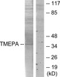 Western blot analysis of lysates from HT-29 cells, using TMEPA Antibody. The lane on the right is blocked with the synthesized peptide.