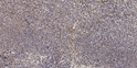 Immunohistochemical analysis of paraffin-embedded human tonsil. 1, Antibody was diluted at 1:200 (4° overnight). 2, STJ95167