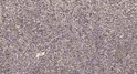 Immunohistochemical analysis of paraffin-embedded human spleen. 1, Tris-EDTA, pH 9.0 was used for antigen retrieval. 2, STJ95178