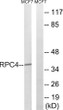 Western blot analysis of lysates from MCF-7 cells, using RPC4 Antibody. The lane on the right was blocked with the STJ95181