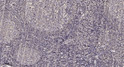 Immunohistochemical analysis of paraffin-embedded human tonsil. 1, Antibody was diluted at 1:200 (4° overnight). 2, STJ95181