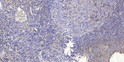 Immunohistochemical analysis of paraffin-embedded human tonsil. 1, Antibody was diluted at 1:200 (4°C overnight). 2, STJ95188