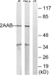 Western blot analysis of lysates from HeLa and Jurkat cells, using PPP2R1B Antibody. The lane on the right is blocked with the synthesized peptide.