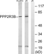 Western blot analysis of lysates from Jurkat and HUVEC cells, using PPP2R5D Antibody. The lane on the right was blocked STJ95194