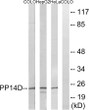 Western blot analysis of lysates from HeLa, HepG2, and COLO cells, using PPP1R14D Antibody. The lane on the right is STJ95202