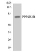 Western blot analysis of lysates from HT-29 cells using PPP2R3B antibody. STJ95211