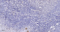 Immunohistochemical analysis of paraffin-embedded human tonsil. 1, Antibody was diluted at 1:200 (4° overnight). 2, STJ95222