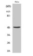 Western blot analysis of various cells using PRIM1 polyclonal antibody cells nucleus extracted by Minute™ cytoplasmic STJ95223