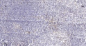 Immunohistochemical analysis of paraffin-embedded human tonsil. 1, Antibody was diluted at 1:200 (4° overnight). 2, STJ95223