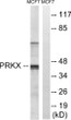 Western blot analysis of lysates from MCF-7 cells, using PRKX Antibody. The lane on the right is blocked with the synthesized peptide.