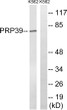 Western blot analysis of lysates from K562 cells, using PRPF39 Antibody. The lane on the right is blocked with the STJ95234