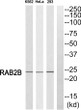 Western blot analysis of RAB2B Antibody. The lane on the right was blocked with the RAB2B peptide. STJ95290