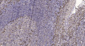 Immunohistochemical analysis of paraffin-embedded human tonsil. 1, Antibody was diluted at 1:200 (4° overnight). 2, STJ95301
