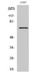 Western Blot analysis of various cells using Rac1 GAP1 Polyclonal Antibody STJ95318