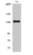 Western Blot analysis of various cells using RACK7 Polyclonal Antibody STJ95320