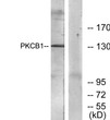 Western blot analysis of lysates from 293 cells, using PKCB1 Antibody. The lane on the right is blocked with the STJ95320