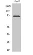 Western Blot analysis of various cells using RBAK Polyclonal Antibody on cells' nuclei extracted by Minute™ Cytoplasmic STJ95390