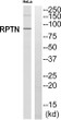 Western blot analysis of RPTN Antibody. The lane on the right is blocked with the RPTN peptide. STJ95417