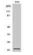 Western blot analysis of various cells using RGS10 Polyclonal Antibody STJ95436