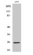 Western blot analysis of various cells using Rho GDIγ Polyclonal Antibody STJ95447