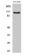 Western blot analysis of various cells using RhoGEF p115 Polyclonal Antibody STJ95453