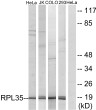 Western blot analysis of lysates from 293, HeLa, COLO, and Jurkat cells, using RPL35 Antibody. The lane on the right is STJ95474
