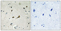 Immunohistochemical analysis of paraffin-embedded Human brain. Antibody was diluted at 1:100 (4°C overnight). High-pressure and temperature Tris-EDTA, pH8.0 was used for antigen retrieval. Negetive contrl (right) obtaned from antibody was pre-absorbed by immunogen peptide.