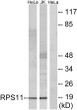 Western blot analysis of lysates from HeLa and Jurkat cells, using RPS11 Antibody. The lane on the right was blocked STJ95486