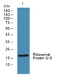 Western blot analysis of lysates from KB cells, primary antibody was diluted at 1:1000, 4°C overnight STJ95490