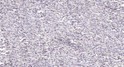 Immunohistochemical analysis of paraffin-embedded human small intestinal stromal tumor. 1, Tris-EDTA, pH 9.0 was used STJ95491