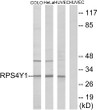Western blot analysis of lysates from HUVEC, HeLa, and COLO cells, using RPS4Y1 Antibody. The lane on the right is blocked with the synthesized peptide.