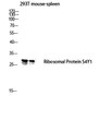 Western blot analysis of 293T mouse-spleen lysis using Ribosomal Protein S4Y1 antibody. Antibody was diluted at 1:1000