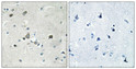 Immunohistochemical analysis of paraffin-embedded Human brain. Antibody was diluted at 1:100 (4°C overnight). High-pressure and temperature Tris-EDTA, pH8.0 was used for antigen retrieval. Negetive contrl (right) obtaned from antibody was pre-absorbed by immunogen peptide.