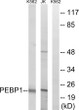 Western blot analysis of lysates from Jurkat and K562 cells, using PEBP1 Antibody. The lane on the right is blocked with the synthesized peptide.