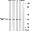 Western blot analysis of lysates from HeLa, Jurkat, HUVEC, and MCF-7 cells, using RNF130 Antibody. The lane on the STJ95519