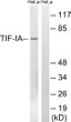 Western blot analysis of lysates from HeLa cells, treated with calyculin A 50 ng/ml 30', using TIF-IA Antibody. The STJ95541