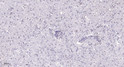Immunohistochemical analysis of paraffin-embedded human brain. 1, Tris-EDTA, pH 9.0 was used for antigen retrieval. 2, STJ95541