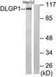 Western blot analysis of lysates from HepG2 cells, using DLGP1 Antibody. The lane on the right was blocked with the STJ95577