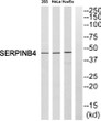 Western blot analysis of SERPINB4 antibody. The lane on the right is blocked with the SERPINB4 peptide. STJ95585