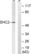 Western blot analysis of lysates from Jurkat cells, using SHC2 Antibody. The lane on the right is blocked with the STJ95587