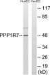 Western blot analysis of lysates from HUVEC cells, using PPP1R7 Antibody. The lane on the right was blocked with the STJ95592