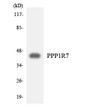 Western blot analysis of the lysates from 293 cells using PPP1R7 antibody. STJ95592